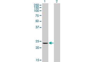 Western Blot analysis of RCV1 expression in transfected 293T cell line by RCV1 monoclonal antibody (M11), clone 2B3.
