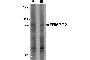 Western Blotting (WB) image for anti-FERM and PDZ Domain Containing 2 (FRMPD2) (N-Term) antibody (ABIN1031387) (FRMPD2 antibody  (N-Term))