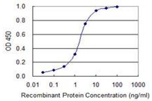 Detection limit for recombinant GST tagged LMTK3 is 0. (LMTK3 antibody  (AA 1151-1250))
