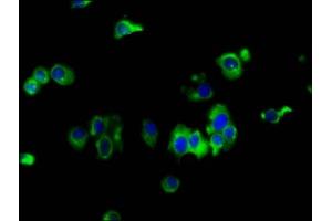 Immunofluorescence staining of MCF-7 cells with ABIN7151929 at 1:133, counter-stained with DAPI. (EMP2 antibody  (AA 22-66))