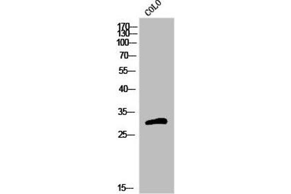 OR5H15 antibody  (C-Term)