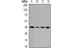 Western blot analysis of GALE expression in HepG2 (A), Hela (B), mouse liver (C), rat liver (D) whole cell lysates. (GALE antibody)
