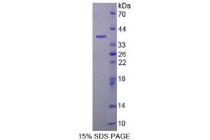 SDS-PAGE (SDS) image for Aminoadipate Aminotransferase (AADAT) (AA 99-425) protein (His tag) (ABIN4990070)