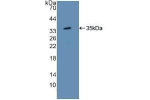 Detection of Recombinant ATF1, Mouse using Polyclonal Antibody to Activating Transcription Factor 1 (ATF1) (AFT1 antibody  (AA 3-245))