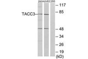 Western blot analysis of extracts from 293/HuvEc cells, using TACC3 Antibody. (TACC3 antibody  (AA 789-838))