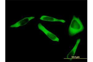Immunofluorescence of purified MaxPab antibody to RARS on HeLa cell. (RARS antibody  (AA 1-660))