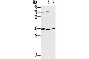 Western Blotting (WB) image for anti-Interleukin 22 Receptor, alpha 2 (IL22RA2) antibody (ABIN2430301) (IL22RA2 antibody)