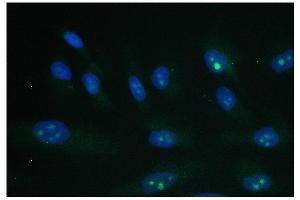 IF analysis of PARN using anti-PARN antibody (ABIN6719422). (PARN antibody  (AA 1-301))
