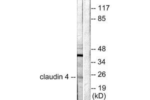 Western blot analysis of extracts from HeLa cells, using Claudin 4 antibody (ABIN5976355). (Claudin 4 antibody  (C-Term))