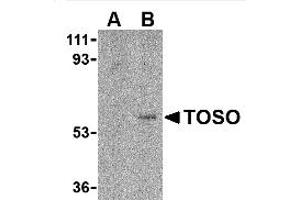 Image no. 1 for anti-Fas Apoptotic Inhibitory Molecule 3 (FAIM3) (C-Term) antibody (ABIN318759) (FAIM3 antibody  (C-Term))