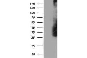 Western Blotting (WB) image for anti-Low Density Lipoprotein Receptor Adaptor Protein 1 (LDLRAP1) antibody (ABIN1496692) (LDLRAP1 antibody)