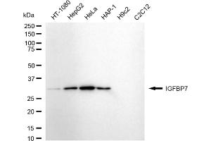 Western blotting analysis using IGFBP7 antibody (ABIN7799057).