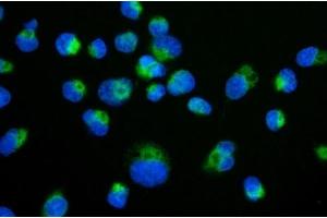 IF analysis of TIMM29 using anti-TIMM29 antibody (ABIN7601495). (TIMM29 antibody  (AA 37-260))