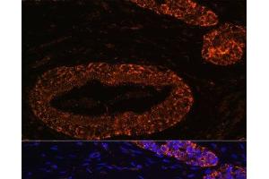 Immunofluorescence analysis of Human breast using RNF31 Polyclonal Antibody at dilution of 1:100 (40x lens). (RNF31 antibody)