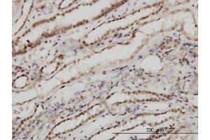 Immunoperoxidase of monoclonal antibody to TSG101 on formalin-fixed paraffin-embedded human kidney. (TSG101 antibody  (AA 201-280))