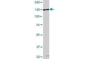 AP3B1 MaxPab polyclonal antibody. (AP3B1 antibody  (AA 1-1094))