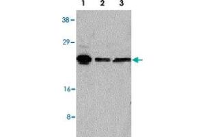 Western blot analysis of 50 ug of whole cell lysates from HeLa (Lane 1), KB (Lane 2) and A-549 (Lane 3) cells with ARC polyclonal antibody  at 1 : 1000 dilution. (ARC (AA 191-208) antibody)