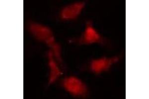 ABIN6274986 staining  Hela cells by IF/ICC. (CEP290 antibody  (Internal Region))