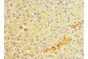 Immunohistochemistry of paraffin-embedded human liver tissue using ABIN7159417 at dilution of 1:100