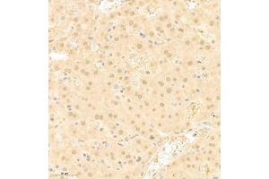 Immunohistochemistry of paraffin embedded mouse liver using RAPGEF5 (ABIN7075365) at dilution of 1:700 (300x lens) (GFR antibody)