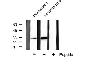 Western blot analysis of CDK5 phosphorylation expression in mouse brain and mouse muscle cell lysates,The lane on the right is treated with the antigen-specific peptide. (CDK5 antibody  (pTyr15))