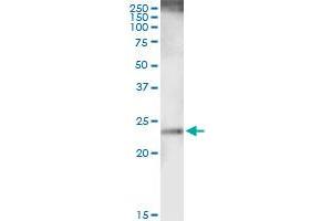 Immunoprecipitation of RAB38 transfected lysate using anti-RAB38 MaxPab rabbit polyclonal antibody and Protein A Magnetic Bead , and immunoblotted with RAB38 purified MaxPab mouse polyclonal antibody (B01P) . (RAB38 antibody  (AA 1-211))
