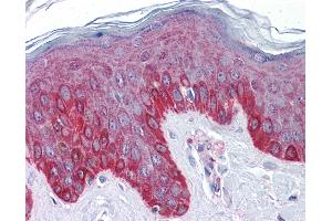Anti-CCDC151 antibody IHC of human skin. (CCDC151 antibody  (C-Term))