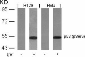 Image no. 2 for anti-Tumor Protein P53 (TP53) (pSer6) antibody (ABIN319211)