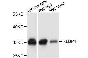 Western blot analysis of extracts of various cell lines, using RLBP1 antibody. (RLBP1 antibody  (AA 1-317))