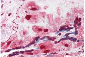 Human Placenta (formalin-fixed, paraffin-embedded) stained with ORAI3 antibody ABIN351441 at 3 ug/ml followed by biotinylated goat anti-rabbit IgG secondary antibody ABIN481713, alkaline phosphatase-streptavidin and chromogen. (ORAI3 antibody  (C-Term))