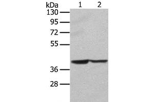 Western Blot analysis of Hela and hepg2 cell using STX16 Polyclonal Antibody at dilution of 1:400 (Syntaxin 16 antibody)