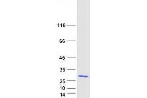 Validation with Western Blot (PYCARD Protein (Transcript Variant 2) (Myc-DYKDDDDK Tag))