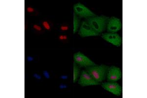 ABIN6259152 and ABIN6274301 staining  cells by IF/ICC. (PITX1 antibody  (Internal Region))