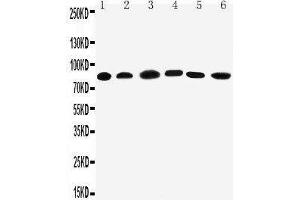 Anti-PC1/3 antibody, Western blotting Lane 1: Rat Liver Tissue Lysate Lane 2: Rat Thymus Tissue Lysate Lane 3: A549 Cell Lysate Lane 4: HELA Cell Lysate Lane 5: COLO320 Cell Lysate Lane 6: PANC Cell Lysate (PCSK1 antibody  (C-Term))