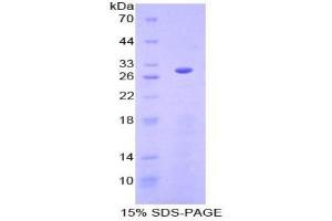 SDS-PAGE of Protein Standard from the Kit (Highly purified E. (Granulin CLIA Kit)