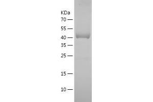 PPIB Protein (AA 34-216) (GST tag)