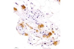 Immunohistochemistry of paraffin embedded rat lung using Calcitonin (ABIN7073271) at dilution of 1:700 (400x lens) (Calcitonin antibody)