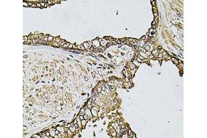 Immunohistochemistry of paraffin-embedded Human prostate using CSTB Polyclonal Antibody at dilution of 1:100 (40x lens). (CSTB antibody)