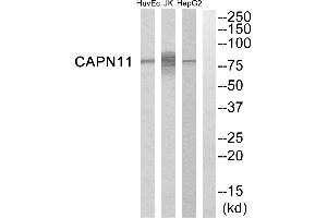 Western blot analysis of extracts from HepG2 cells, Jurkat cells and HuvEc cells, using CAPN11 antibody. (CAPN11 antibody)