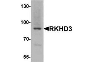 Western blot analysis of RKHD3 in mouse skeletal muscle tissue lysate with RKHD3 antibody at 1 ug/mL. (MEX3B antibody  (Middle Region))
