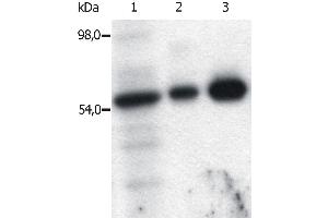 Immunoprecipitation (IP) image for anti-FYN Oncogene Related To SRC, FGR, YES (FYN) (AA 7-176) antibody (ABIN94311)