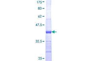 B3GALT6 Protein (AA 229-329) (GST tag)