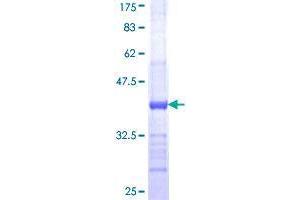 B3GALT6 Protein (AA 229-329) (GST tag)