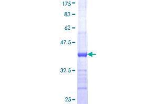 B3GALT6 Protein (AA 229-329) (GST tag)