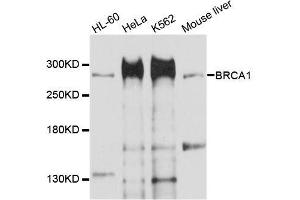 Western blot analysis of extracts of various cell lines, using BRCA1 antibody. (BRCA1 antibody  (AA 400-699))