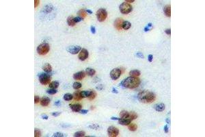 Immunohistochemical analysis of HMG-20A staining in mouse brain formalin fixed paraffin embedded tissue section. (HMG20A antibody)