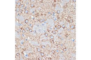 Immunohistochemistry of paraffin-embedded rat brain using GOT2 Rabbit mAb (ABIN7267427) at dilution of 1:100 (40x lens). (GOT2 antibody)