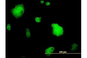 Image no. 4 for anti-Slingshot Homolog 3 (SSH3) (AA 293-392) antibody (ABIN599261) (SSH3 antibody  (AA 293-392))