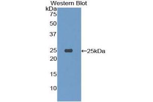 Western blot analysis of the recombinant protein. (TREM1 antibody  (AA 21-230))