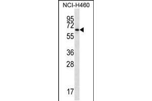 Western blot analysis in NCI-H460 cell line lysates (35ug/lane). (ZBTB46 antibody  (AA 251-279))
